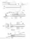 Fig. 12 - METHODS AND DEVICES FOR BIOPSY AND COLLECTION OF SOFT TISSUE