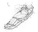 Fig. 01 - Method and apparatus for immobilizing subjects undergoing mechanical CPR