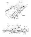 Fig. 04 - Method and apparatus for immobilizing subjects undergoing mechanical CPR