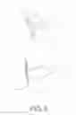 Fig. 07 - Modular shoulder external rotation wedge system and method