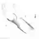 Fig. 02 - Orthopedic Cast and Method to Manufacture Same