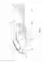 Fig. 05 - Orthopedic Cast and Method to Manufacture Same