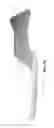 Fig. 13 - Orthopedic Cast and Method to Manufacture Same