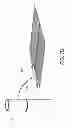 Fig. 17 - Orthopedic Device For Use With An Orthopedic Cast