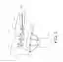 Fig. 05 - Wrist orthotic including adjustable ulna gap