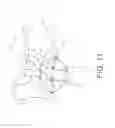 Fig. 13 - Wrist orthotic including adjustable ulna gap