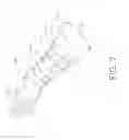 Fig. 08 - Wrist orthotic with taper adjusting binding strap
