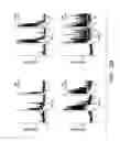 Fig. 07 - Compositions and methods for controlling neuronal excitation