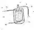 Fig. 10 - Device and method for cooling a patient