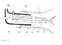 Fig. 15 - Device and method for cooling a patient