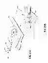 Fig. 45 - Apparatuses and methods for negative pressure wound therapy