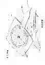 Fig. 49 - Apparatuses and methods for negative pressure wound therapy