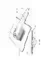 Fig. 71 - Apparatuses and methods for negative pressure wound therapy