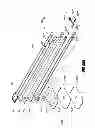 Fig. 85 - Apparatuses and methods for negative pressure wound therapy
