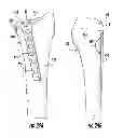 Fig. 22 - Combination holder/impactor and bone plate for fracture fixation
