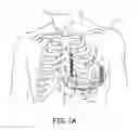 Fig. 02 - Multi-mode implantable medical device