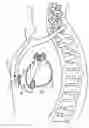 Fig. 01 - Substernal leadless electrical stimulation system