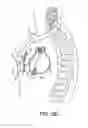 Fig. 07 - Substernal leadless electrical stimulation system