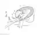 Fig. 05 - System and method for transaortic delivery of a prosthetic heart valve