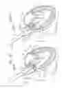 Fig. 06 - System and method for transaortic delivery of a prosthetic heart valve