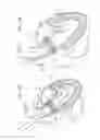 Fig. 07 - System and method for transaortic delivery of a prosthetic heart valve