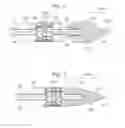 Fig. 10 - System and method for transaortic delivery of a prosthetic heart valve