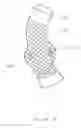 Fig. 07 - Personalized aortic valve prosthesis