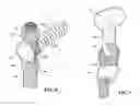 Fig. 06 - CLAMPING ASSEMBLIES FOR SECURING LIGAMENTS TO A BONE