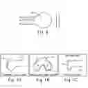 Fig. 06 - Method of designing orthopedic implants using in vivo data
