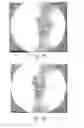 Fig. 22 - Method of designing orthopedic implants using in vivo data