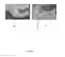 Fig. 07 - METHOD OF ENHANCING FLAT SPOTS IN THREE-DIMENSIONAL SEISMIC INTERPRETATION