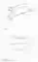 Fig. 02 - Protective head guard