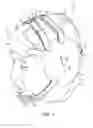 Fig. 02 - WRESTLING HEADGEAR
