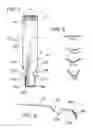Fig. 04 - SPLIT FUNNEL HEAD STRAWBERRY LEAF STEM CORE EXTRACTOR TOOL