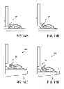 Fig. 09 - Variable cutting length hair clipping system