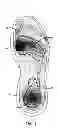 Fig. 02 - Shoe assembly with non-linear viscous liquid