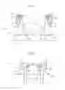 Fig. 02 - Bush component force detection device