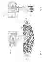 Fig. 02 - Measuring transducer as well as measuring system formed therewith