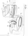 Fig. 12 - Breathable gas apparatus with humidifier