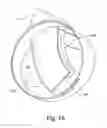 Fig. 16 - Breathable gas apparatus with humidifier
