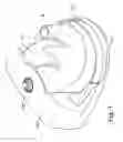 Fig. 04 - Breathable gas apparatus with humidifier