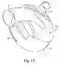Fig. 15 - Breathable gas apparatus with humidifier