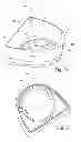 Fig. 23 - Breathable gas apparatus with humidifier