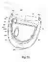 Fig. 25 - Breathable gas apparatus with humidifier