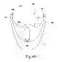Fig. 37 - Breathable gas apparatus with humidifier