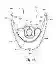 Fig. 38 - Breathable gas apparatus with humidifier
