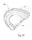 Fig. 41 - Breathable gas apparatus with humidifier
