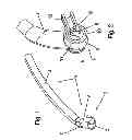 Fig. 02 - Nasal adapter system for CPAP respiration