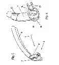 Fig. 03 - Nasal adapter system for CPAP respiration