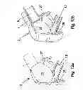 Fig. 08 - Nasal adapter system for CPAP respiration